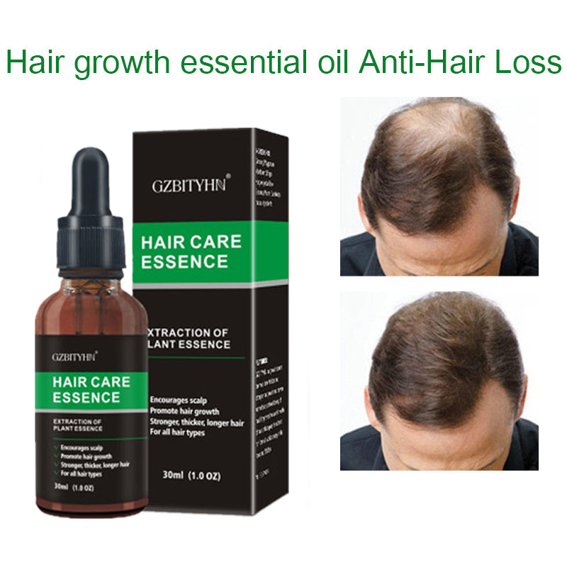 Hair Growth Care Essential Oil – Nourishing Scalp & Hair Care Oil (OEM)